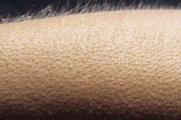 Бывали ли у вас мурашки на коже от музыки? На языке учёных этот эффект называется фриссон